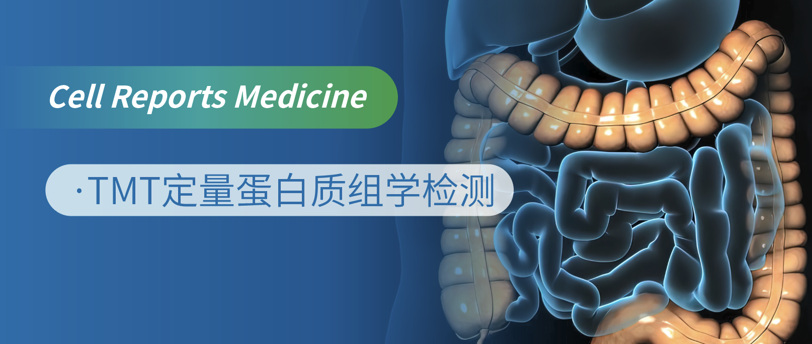 多组学深入揭秘EOCRC分子特征与免疫分型